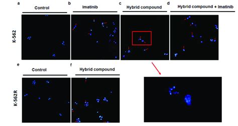 Apoptotic Morphological Changes Observed By DAPI Staining After 48 H Of