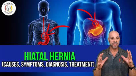 Hiatal Hernia Causes Symptoms Diagnosis Treatment YouTube