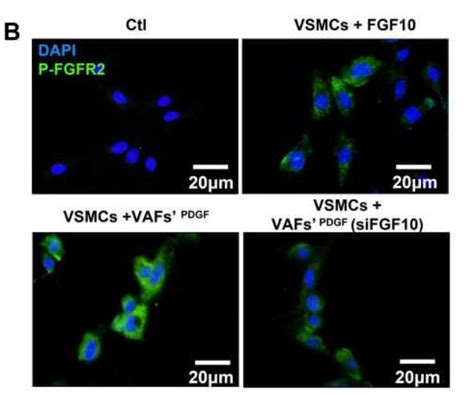 Phospho Fgfr1234 Tyr653tyr654 Antibody Affinity Biosciences Ltd