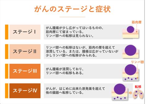 最大67％オフ！ 医者が体験した末期ガンからの生還