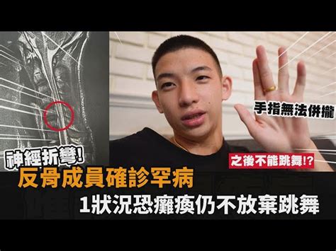 反骨18歲成員確診罕病！1狀況恐癱瘓仍不放棄跳舞：誰都無法阻止我－全民話燒 民視新聞網