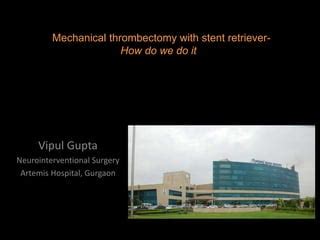 Mechanical Thrombectomy With Stent Retriever PPT