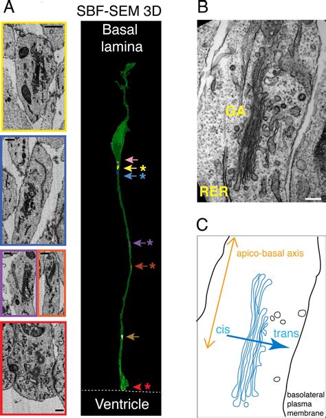 Electron Microscopy Analyses Of The Golgi Apparatus In ARG A SBF SEM