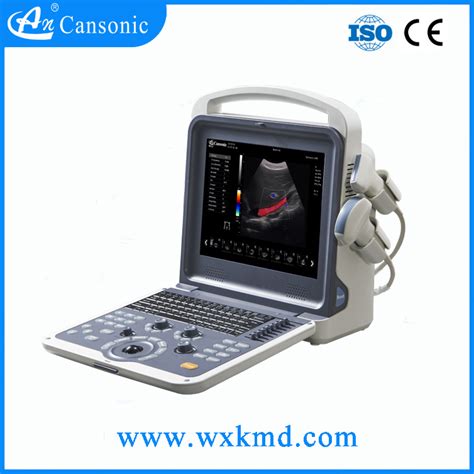 4D Fetal Color Doppler Ultrasound Scanner 4D Ultrasound Scanner And