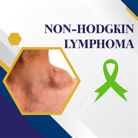 Non-Hodgkin Lymphoma - UHAPO