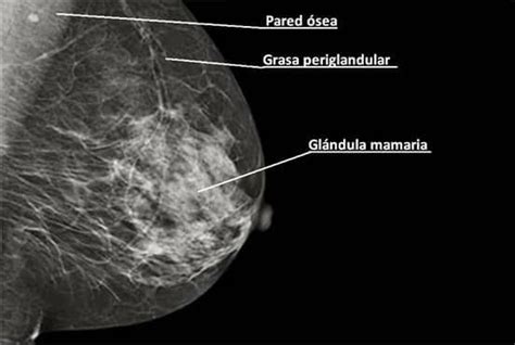 Mamografia Glándula Mamaria Anatomía Humana Anatomía