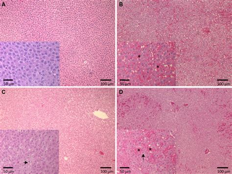 Representative Micrographs Of Hematoxylin And Eosin Stained Liver