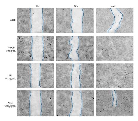 Scratch Wound Assay Huvec Wounds Were Created Using Pipette Tips And