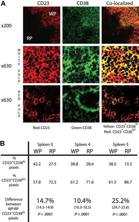 CD38 Expression Is Higher On CLL Cells Derived From Splenic White Pulp