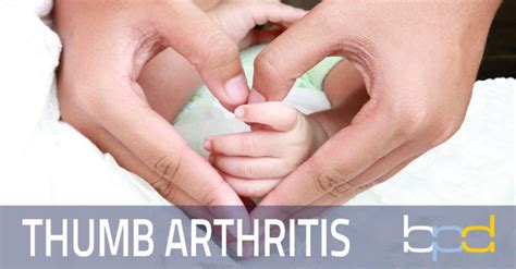 Basal Joint Arthritis Symptoms and Treatment - Brandon P. Donnelly, MD