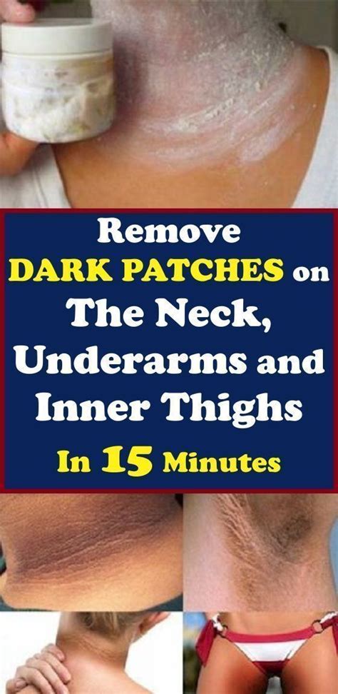 How To Whiten Dark Neck With Baking Soda Inner Thigh Skin