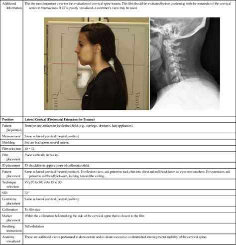 Radiographic Positioning | Radiology Key