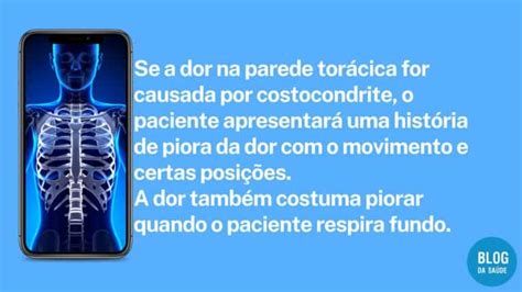 Costocondrite O Que é Causas Sintomas E Tratamentos Blog Da Saúde