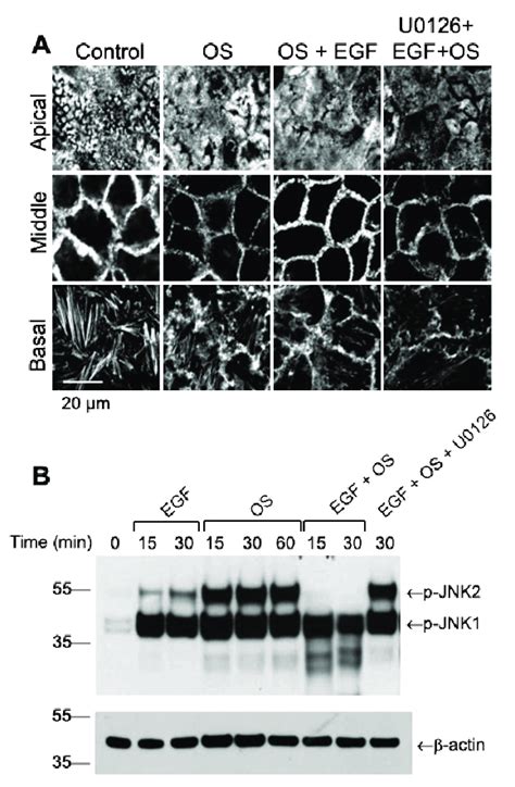 Egf Prevents Osmotic Stress Induced Actin Cytoskeleton Remodeling By A