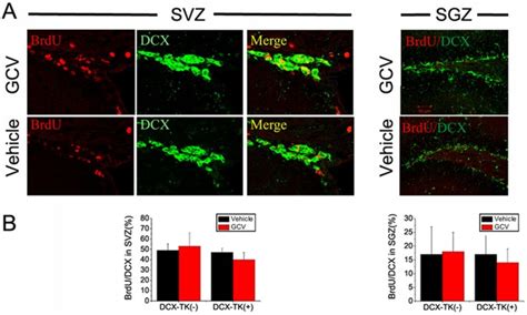 A Two Photon Confocal Images Of Brdu Red Dcx Green And