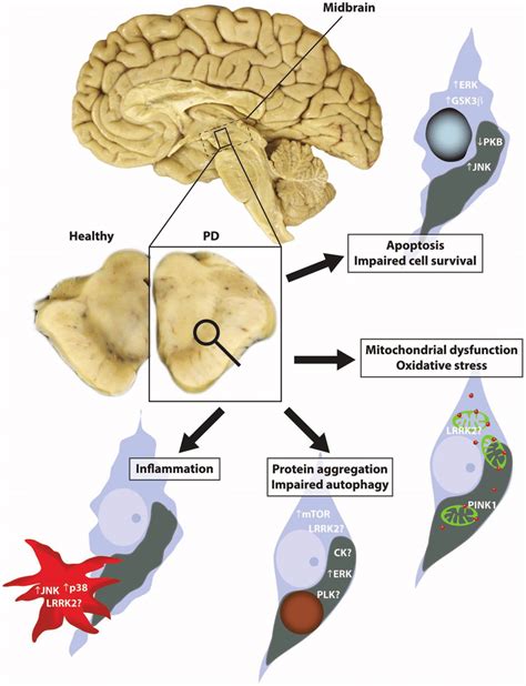 Kinases Implicated In Parkinsons Disease Pd Pd Is Characterized