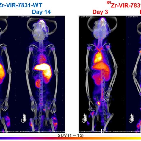 Representative D Co Registered Pet Ct Maximum Intensity Projection