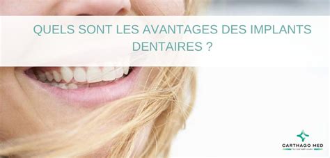 Quels Sont Les Avantages Des Implants Dentaires Carthago Med