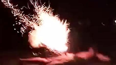 Territory Day firework incident: Man loses hand after firework accident ...