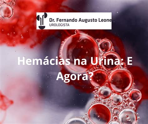 Hemácias na Urina e Agora Dr Fernando Leone Urologista BH