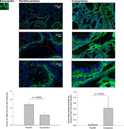 Immunoshistochemical Fibronectin Staining With Immunofluorescence