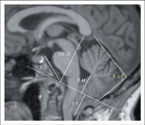 Figure 1 From Evidence For Sex Differences In Morphological