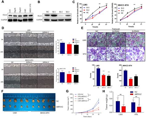 Obg Like Atpase Ola Overexpression Predicts Poor Prognosis And