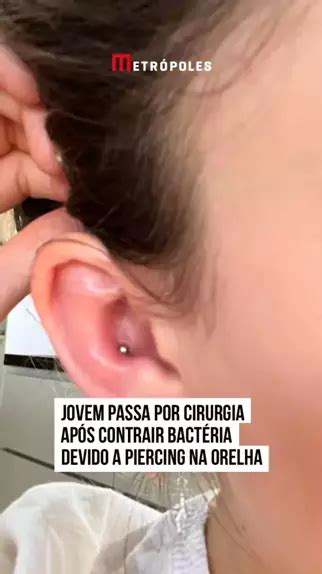 Que Desespero Uma Jovem De 21 Anos Precisou Passar Por Uma Cirurgia