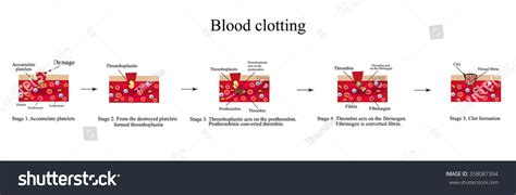 304 Blood Clotting Process Images, Stock Photos & Vectors | Shutterstock