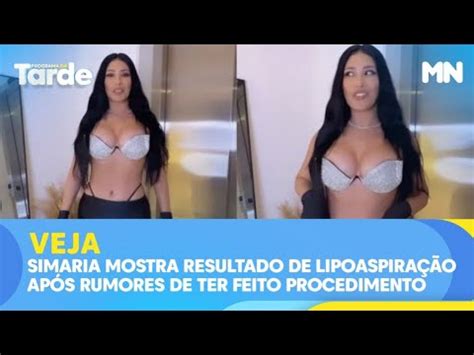 Simaria mostra resultado de lipoaspiração após rumores de ter feito