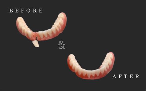how to fix a broken denture