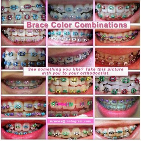 Color Combinations Cute Braces Colors Cute Braces Braces Colors