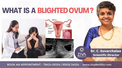 What Is Blighted Ovum In Pregnancy Female Infertility Problems Dr