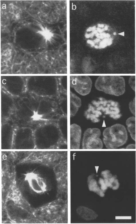 Prophase and pmmetaphase centrioles have long astral microtubules which ...