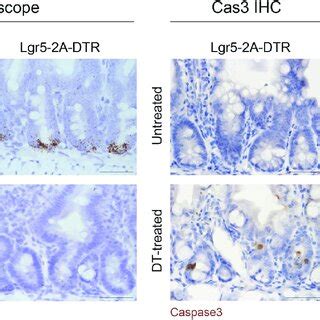 Expected Outcomes From In Vivo Ablation Of Lgr Expressing Cells Within