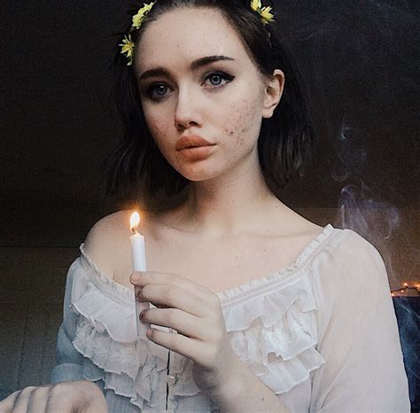 Блогерша, взорвавшая Instagram: Прыщи не значат, что вы не можете быть ...