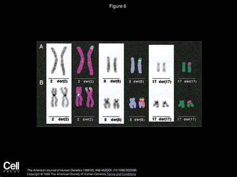 Multiplex Fish For Pre And Postnatal Diagnostic Applications Ppt