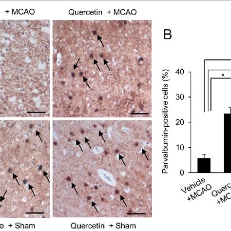 Immuno Staining Of Parvalbumin In Vehicle Middle Cerebral Artery