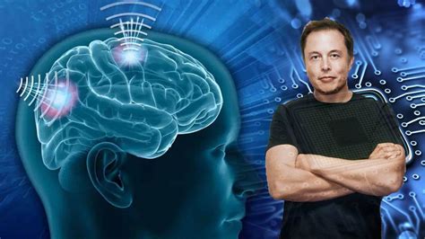 Elon Musk Anuncia Que Su Empresa Neuralink Comenzará A Fabricar Implantes Para Cerebros Humanos