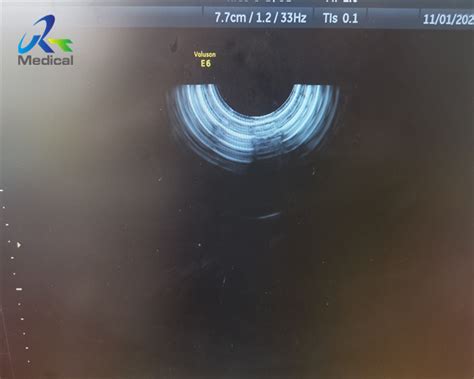 Ge Ric D Ultrasound Probe Repair D Replace Dome