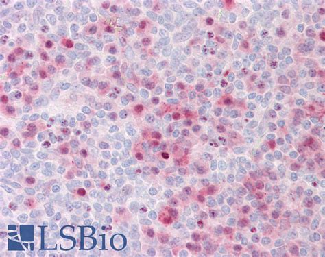 Ihc Plus Braf B Raf Polyclonal Antibody Rabbit Anti Human Lsbio