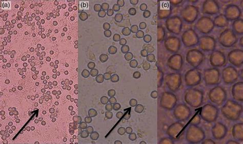 Acanthamoeba Cysts Cultivated From Natural Spring Water Samples In Download Scientific