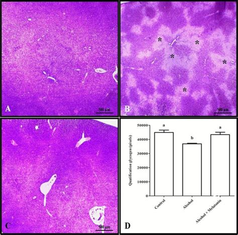 Histochemistry for glycogen in the liver of females in experimental ...