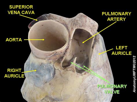 Pulmonic regurgitation pathophysiology - wikidoc