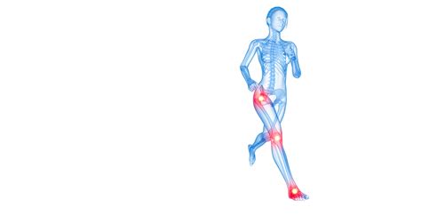 Magnetotherapy for chondropathy treatment | Osteoplus®