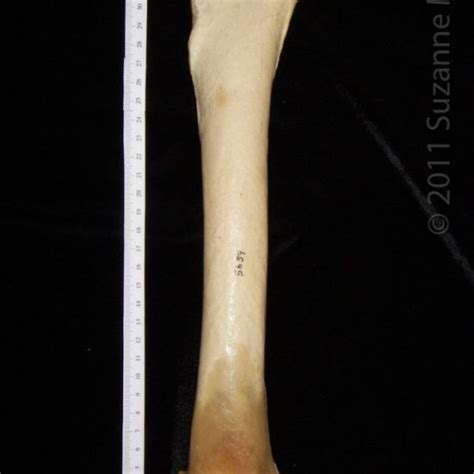 Posterior View Right Black Bear Femur Boneid