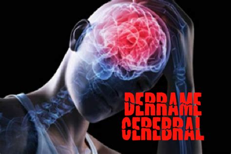 Derrame Cerebral English