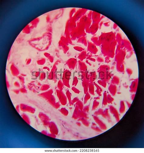 Photo Adipose Tissue Under Microscope Stock Photo 2208238165 | Shutterstock