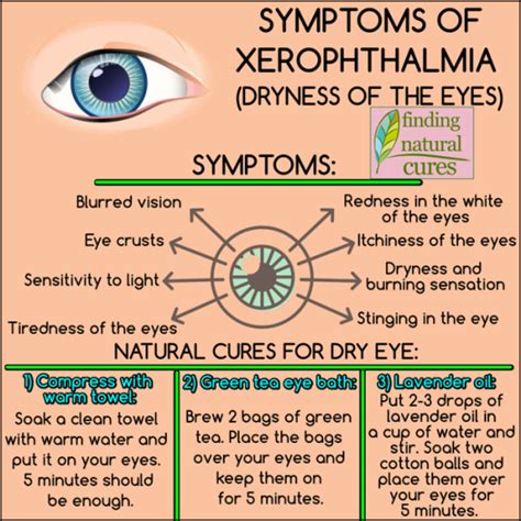 Symptoms Of Xerophthalmia Dryness Of The Eyes Findingnaturalcures