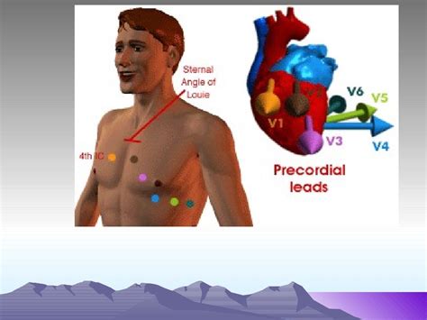 12 Lead Ecg